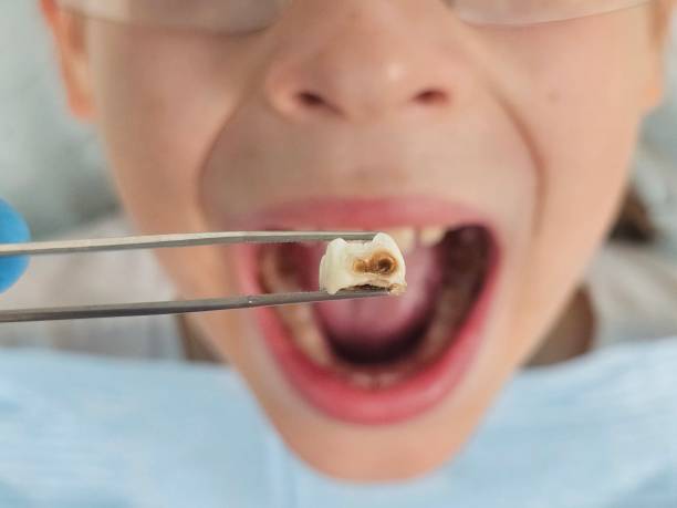 Best Broken Tooth Emergency  in Shelbyville, KY